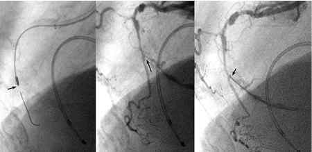 Fig16sc