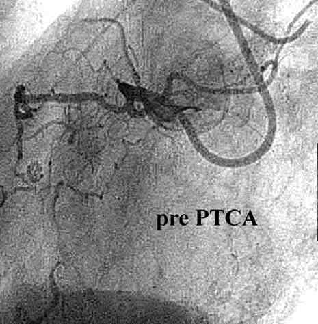 Fig20a