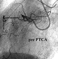 Fig20a